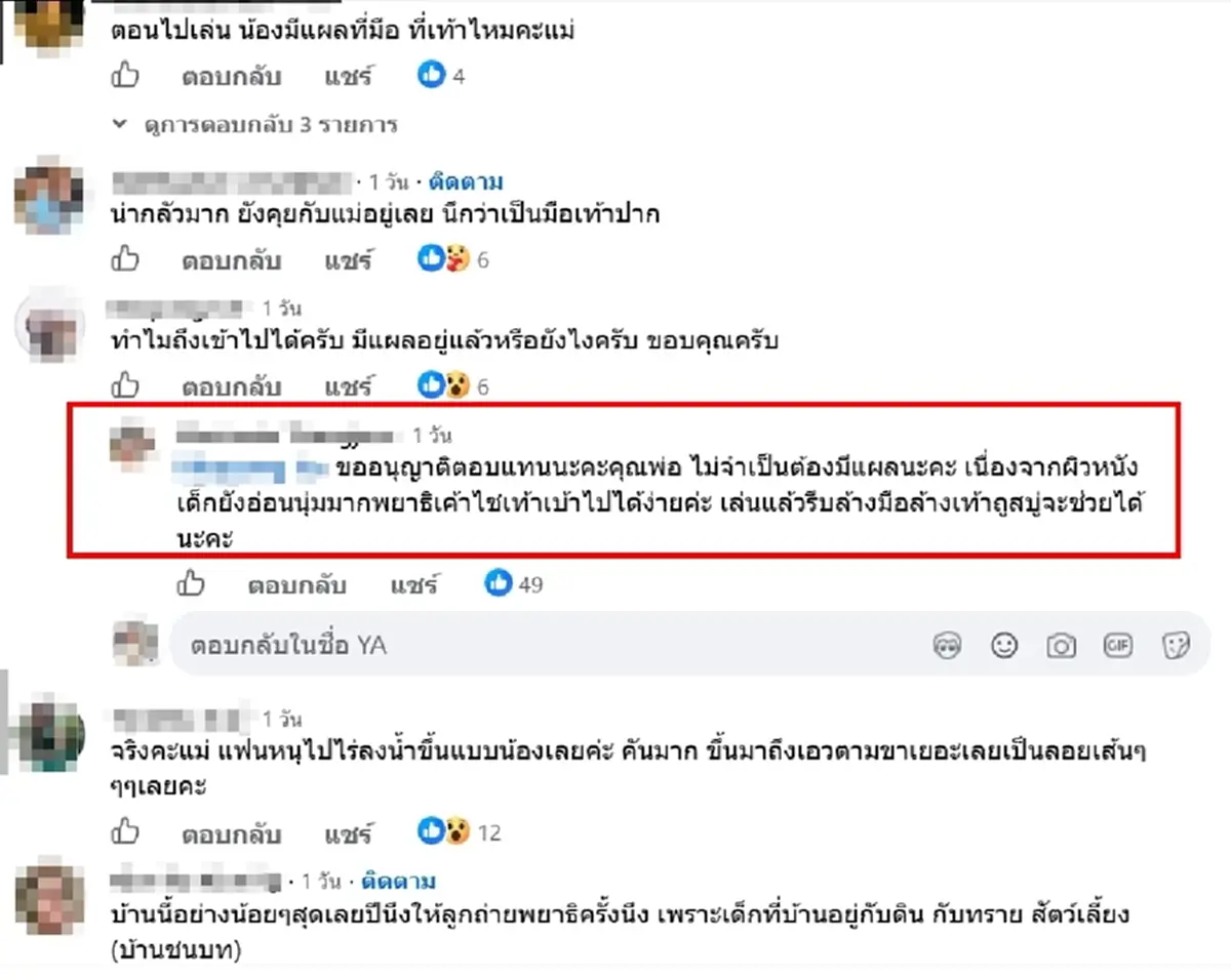 ใครจะคิด พาลูกเล่นทราย กลับมาคันหนัก สุดท้ายเจอพยาธิไชมือ-เท้า