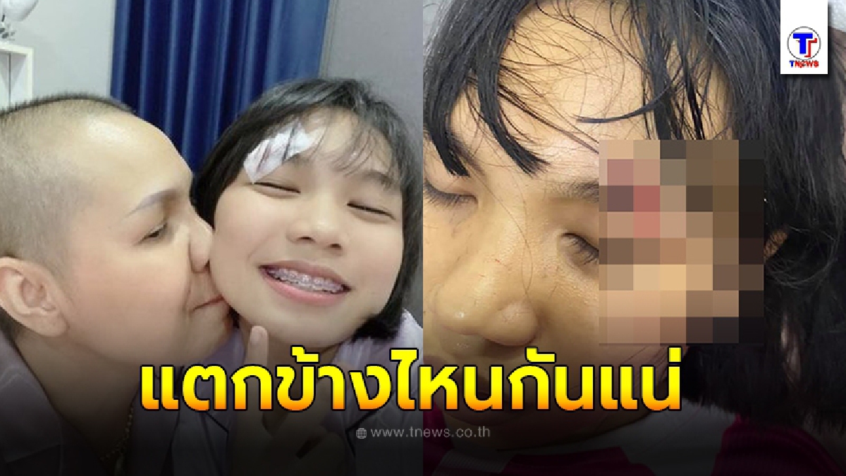 ชาวเน็ตผิดสังเกต น้องลิลลี่ หัวฟาดพื้น