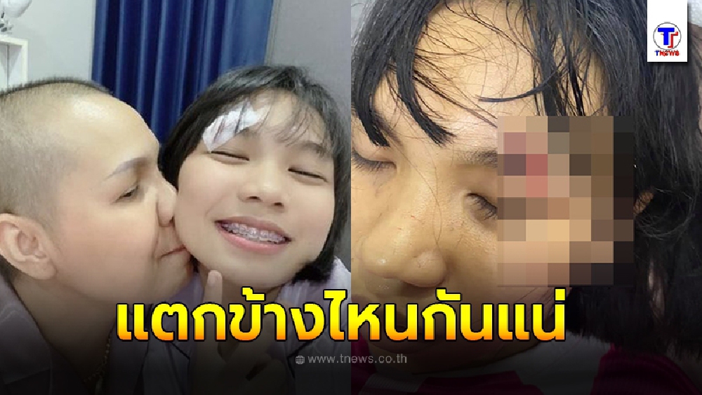 ชาวเน็ตผิดสังเกต น้องลิลลี่ หัวฟาดพื้น