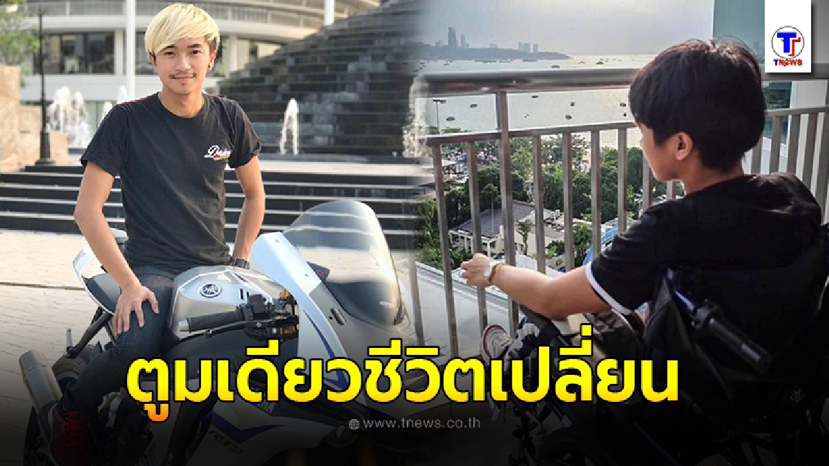 หนุ่มนักบิด เผยอุทาหรณ์ ซิ่งรถ จนกระดูกหักทั้งร่าง ค่ารักษา 3 ล้าน