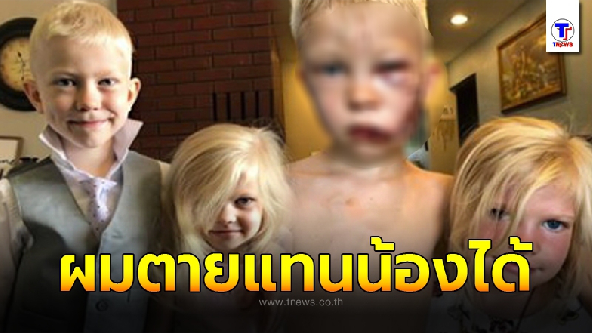เด็กหนุ่มวัย 6 ขวบ ต่อสู้กับสุนัข