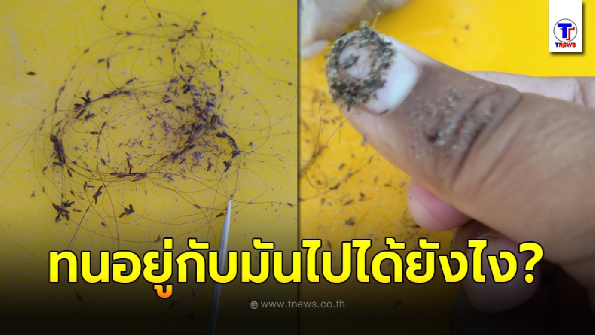 สาวหมดคำบรรยาย คุยกับเพื่อนอยู่ดีๆ เห็นแมลงตัวเล็กไต่ออกมาจากผมของเพื่อน ตัดสินใจขอเปิดดูถึงขั้นขนหัวลุก