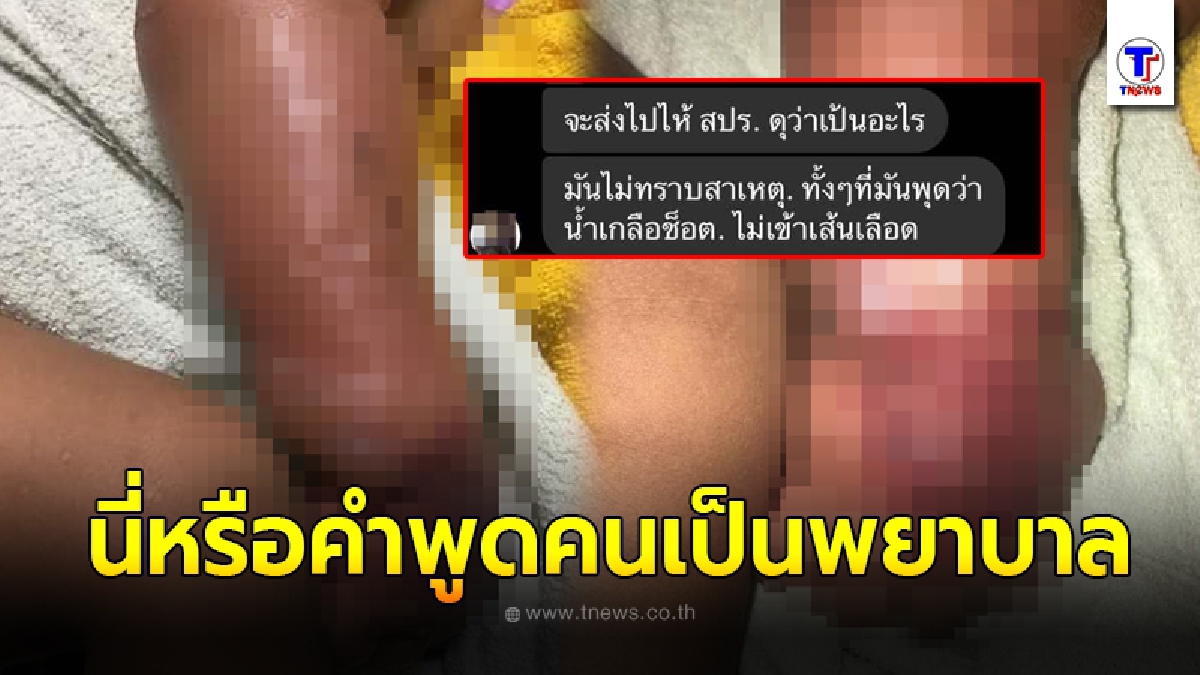 ญาติแฉยับ หลานวัย 9 เดือนเข้ารพ.ให้น้ำเกลือจู่ๆมือบวมไหม้เรียกพยาบาลมาดูโบ้ยเป็นความผิดคนเฝ้า