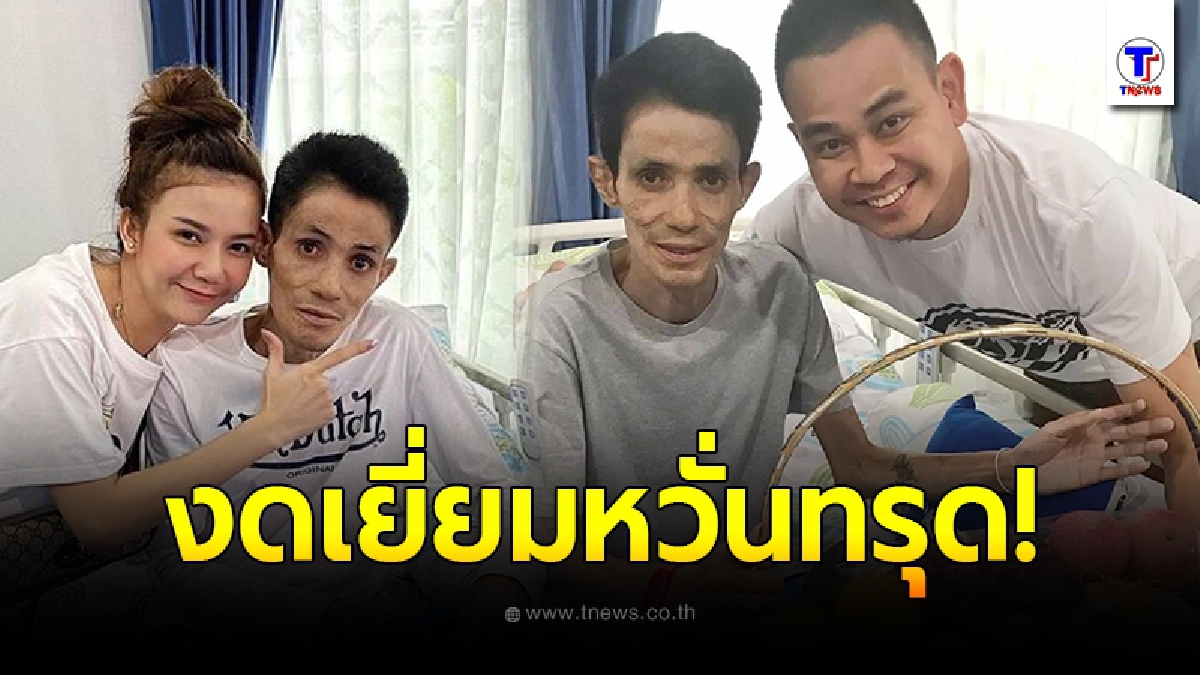 แพทย์หวั่น โรเบิร์ต สายควัน ทรุด สั่งงดเยี่ยม หลังป่วยหนัก