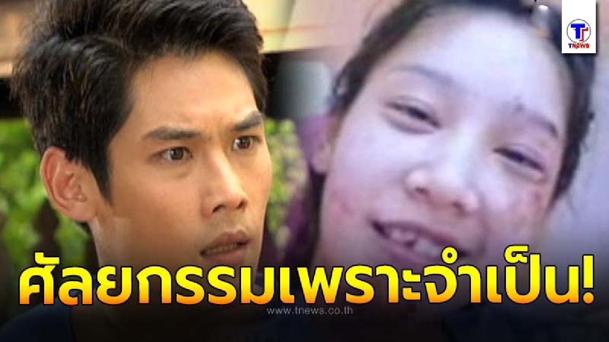 5 ดารา ไม่ได้ตั้งใจศัลยกรรม แต่ต้องทำเพราะความจำเป็น