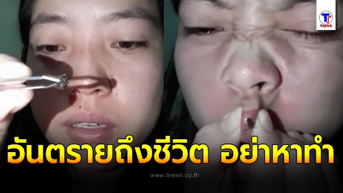 หมอแล็บแพนด้า ออกเตือน อย่าหาทำ ให้ผึ้งต่อยหวังปากกระจับ พลาดอาจถึงตาย