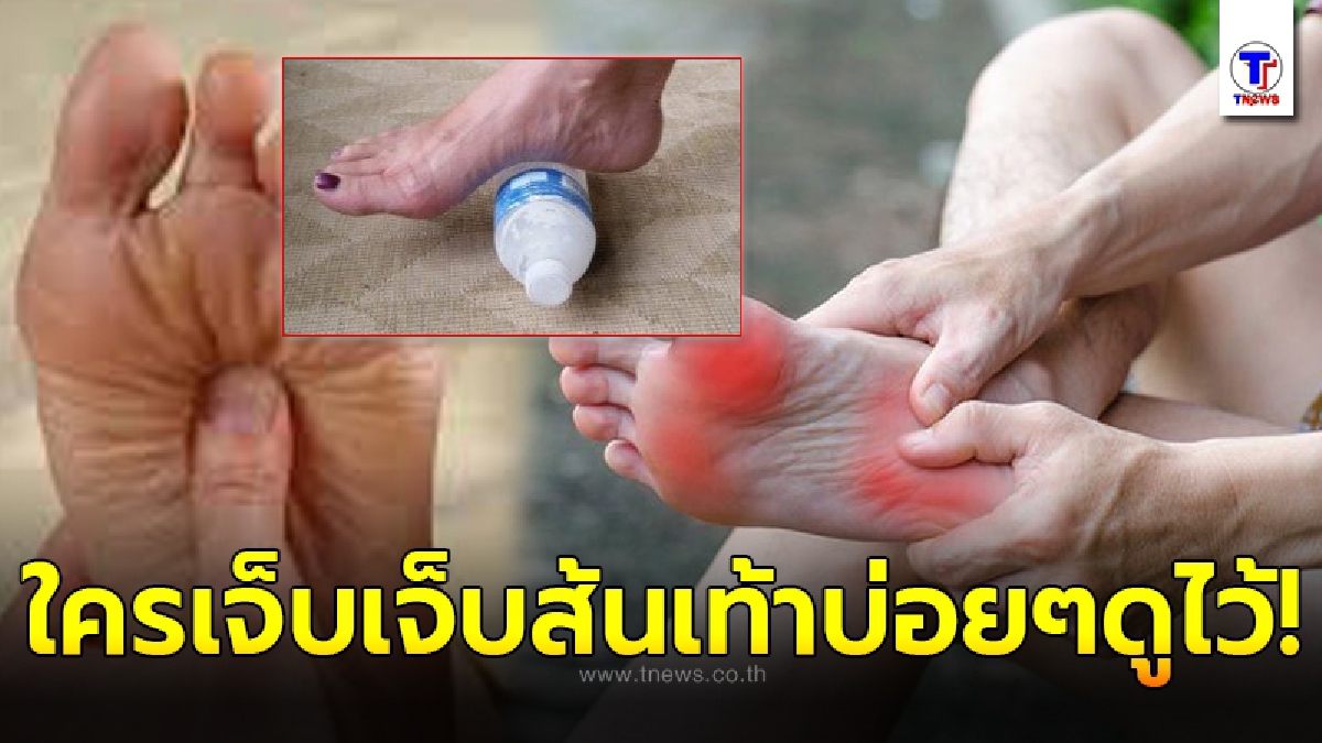 เทคนิคแก้ปัญหา เจ็บส้นเท้า ฝ่าเท้า ในตอนเช้าที่ลุกขึ้นยืน พร้อมวิธีป้องกันไม่ให้เป็นอีก
