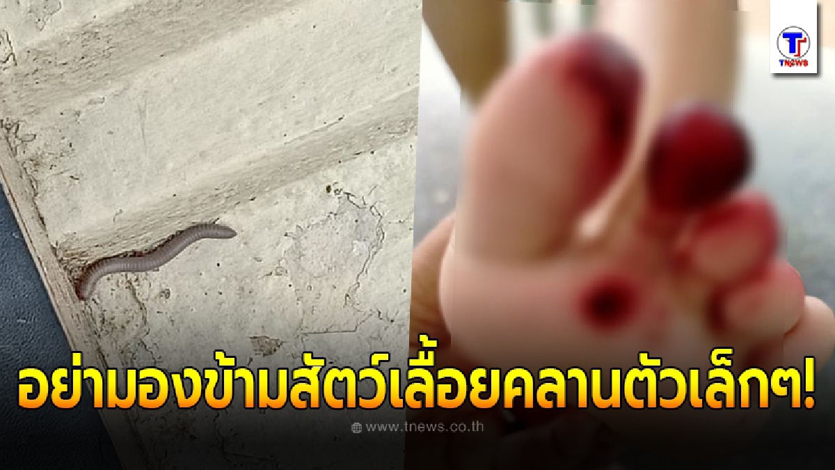 แพทย์เตือน กิ้งกือ บางสายพันธุ์มีพิษร้าย สามารถพ่นออกไปได้ไกล แค่สัตว์เลื้อยคลานตัวเล็กๆก็มองข้ามไม่ได้