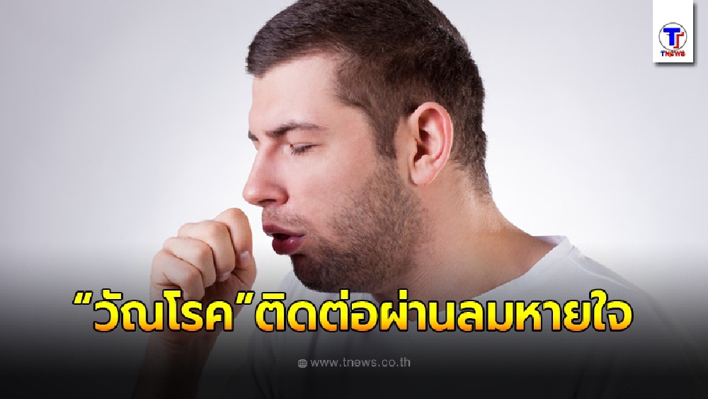 เจาะอาการ "วัณโรค" อีกหนึ่งภัยเงียบ ติดต่อผ่านลมหายใจ รุนแรงถึงขั้นเสียชีวิต