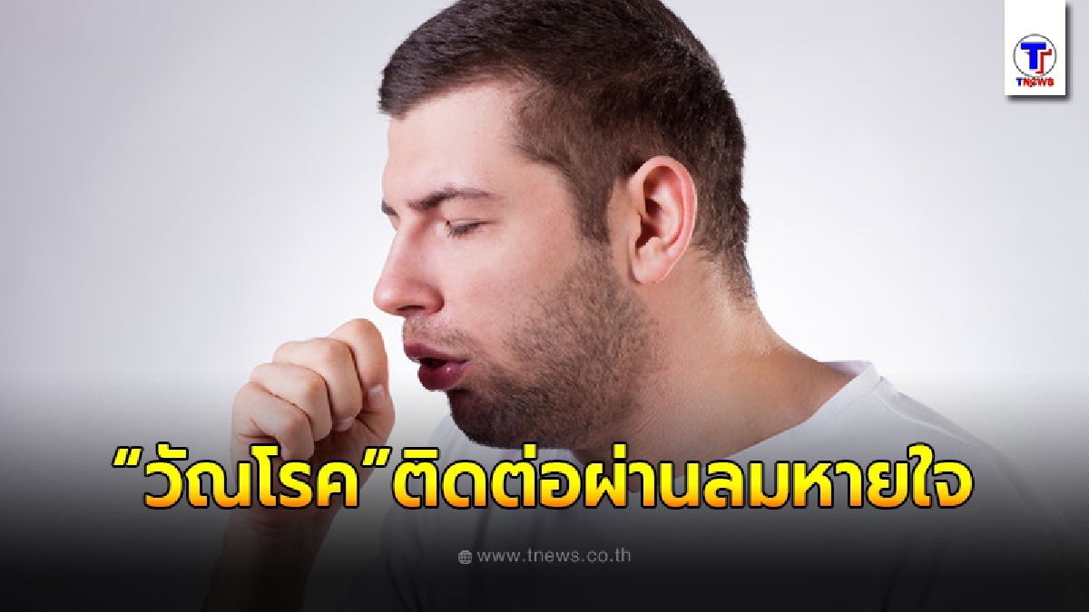 เจาะอาการ "วัณโรค" อีกหนึ่งภัยเงียบ ติดต่อผ่านลมหายใจ รุนแรงถึงขั้นเสียชีวิต