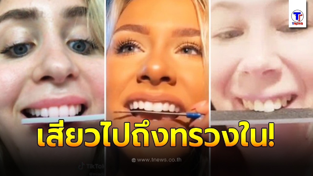 หมอฟันรีบเบรคหัวทิ่ม เทรนด์ใหม่ของเหล่าเน็ตไอดอล ที่มาพร้อมความอันตราย