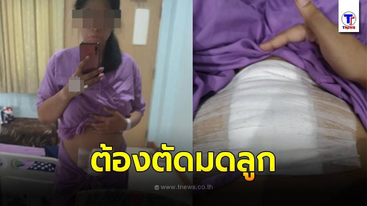 สาวเล่าประสบการณ์เป็นมะเร็งเยื่อบุโพรงมดลูกในวัย29ปี