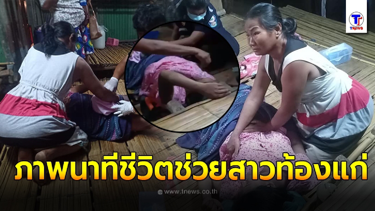 ภาพนาทีชีวิต สาวมอญ เจ็บท้องคลอด ก่อนพบสายรกพันคอเด็ก โชคยังดีกู้ภัยเร่งช่วยรอดมาได้ปลอดภัยทั้งแม่ลูก