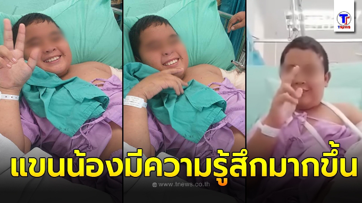 อาการล่าสุด น้องแมนยู ตอนนี้แขนเริ่มมีความรู้สึกมากขึ้น