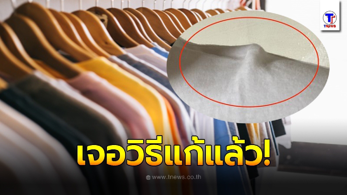 วิธีแก้เสื้อเสียทรงจากไม้แขวน ในที่สุดก็เจอแล้ว ทำง่ายได้ผลจริง