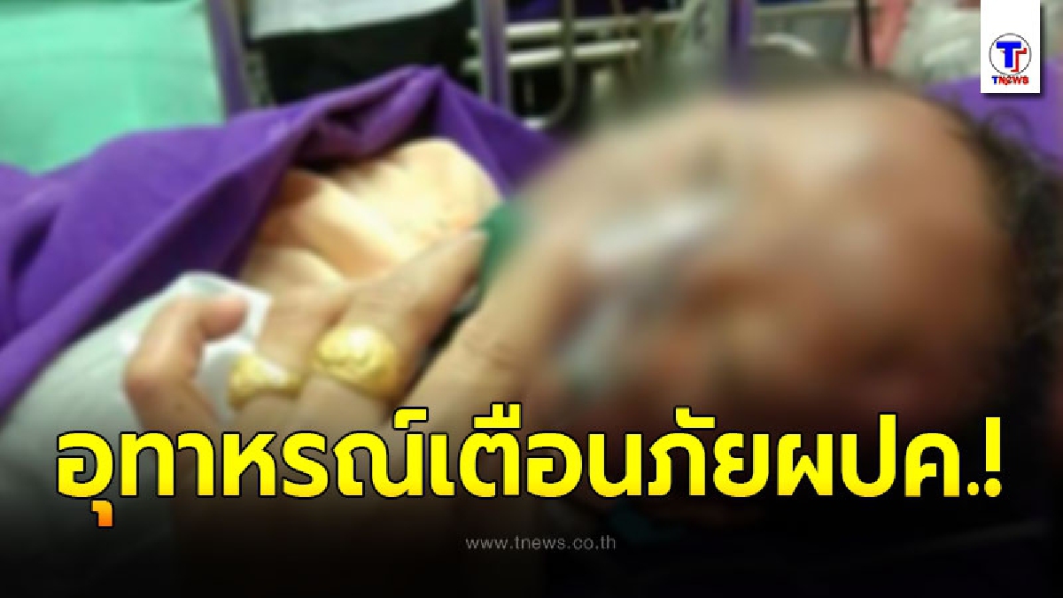 อุบัติเหตุสลด ลูกโป่งอัดแก๊สระเบิดใส่ 2 ขวบ อาการสาหัส