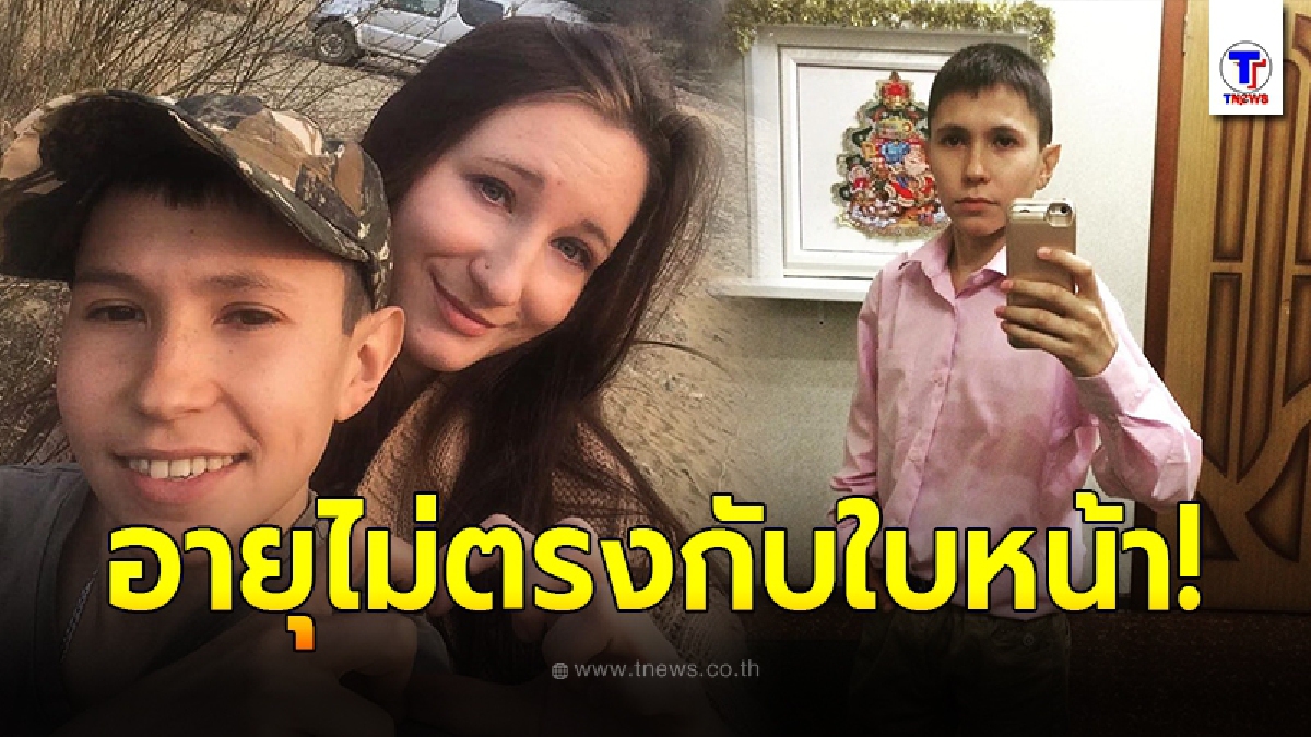 เปิดภาพ หนุ่มรัสเซีย ผู้มีรูปลักษณ์อ่อนกว่าวัย อายุ 32 แต่กลับดูเหมือนเด็กอายุ 14