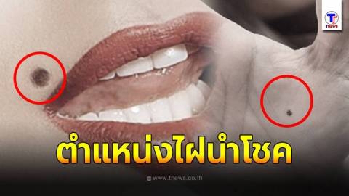 โหงวเฮ้ง ไฝ 7 ตำแหน่ง นำความโชคดี ความร่ำรวย