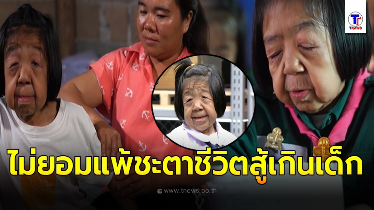 เปิดชีวิต น้องเจนนี่ หนูน้อยวัย 11 ปี ป่วยโรคชราในเด็ก แต่กำลังใจเหลือล้นมีแม่อยู่ข้างๆ