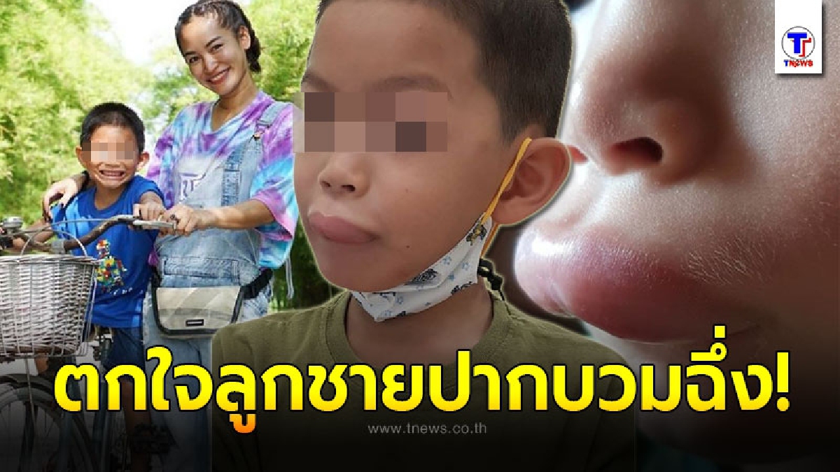 พลอย อดีตภรรยา ปีเตอร์ คอร์ป เผยภาพลูกชายน้องพูม่า ปากบวมฉึ่ง ก่อนเฉลยใครเป็นคนทำ