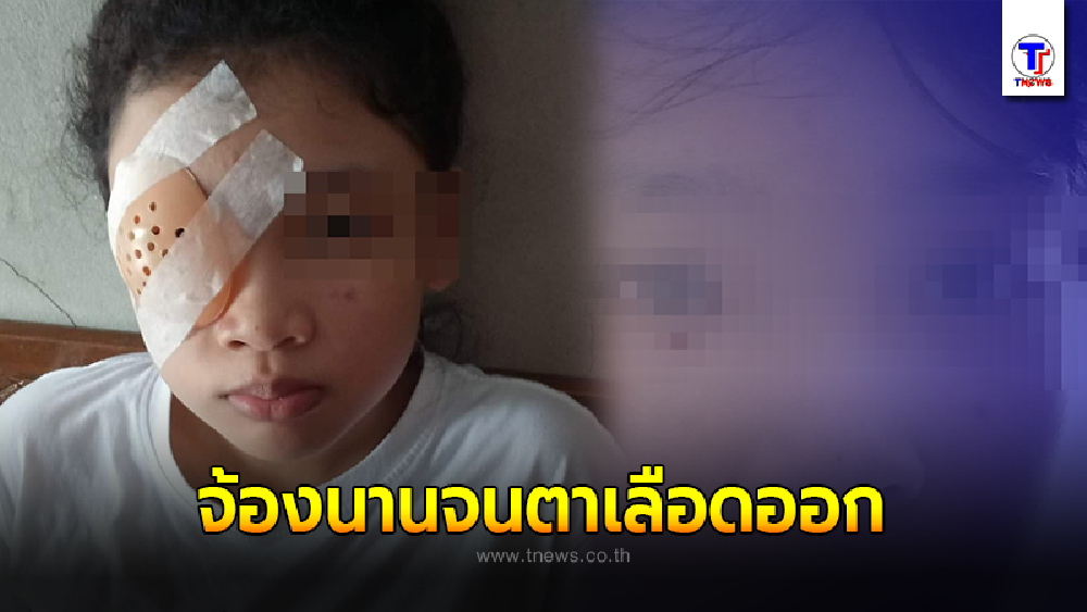 แม่โพสต์เล่าอุทาหรณ์ หลังลูกสาวจ้องมือถือนาน สุดท้ายเลือดออกตา