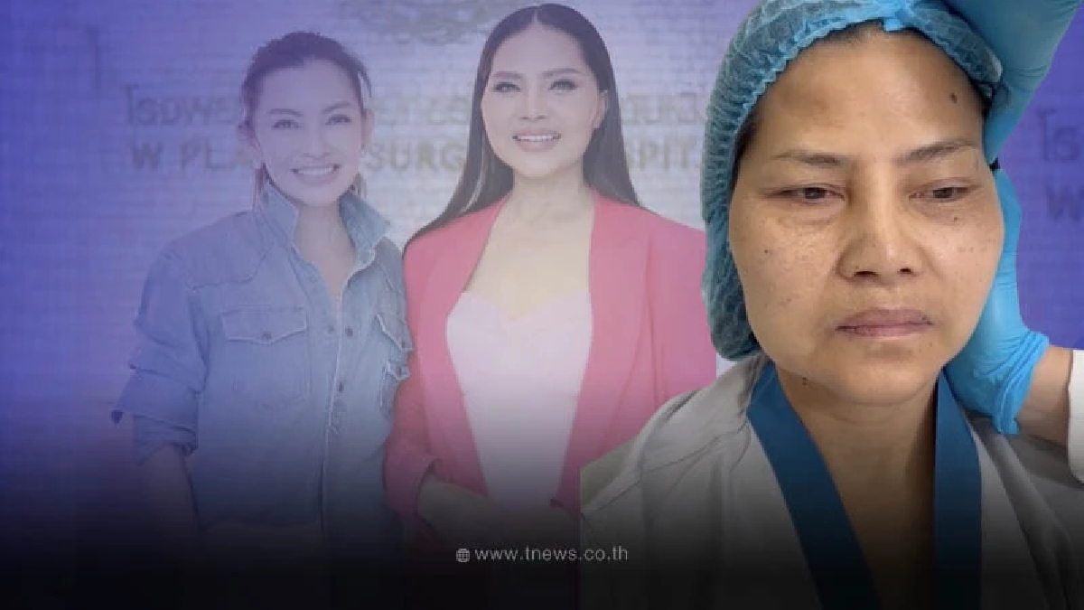 ภาพล่าสุด สุนารี ราชสีมา หลังทำศัลยกรรมครบ 1 เดือน สวยหน้าเด็กมากจริงๆ