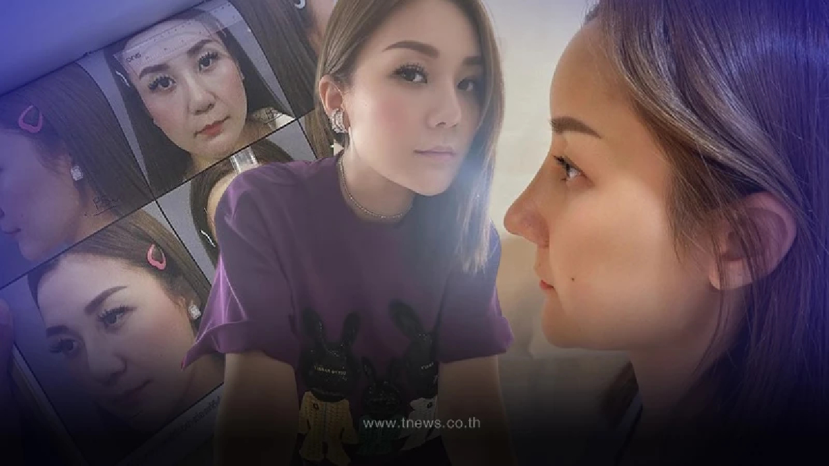 เปิดภาพล่าสุด “เอ็ม บุษราคัม” ทายาท “หม่ำ จ๊กมก” ทุบหน้าใหม่ สวยปังมาก