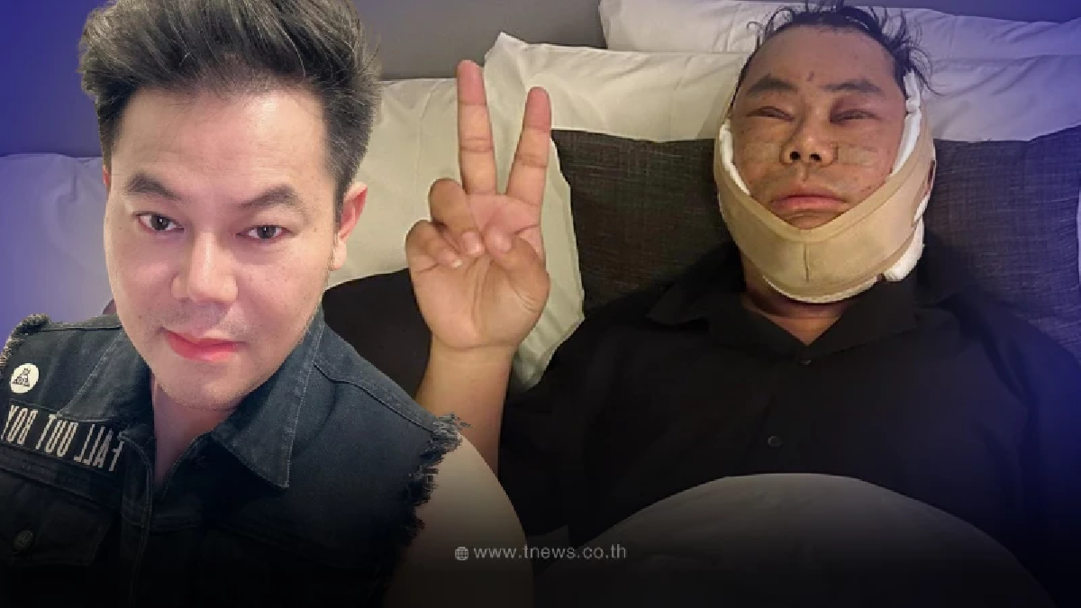 เพชร สหรัตน์ ตัดสินใจครั้งใหญ่ทำศัลยกรรมครั้งแรกในวัย 43 ปี