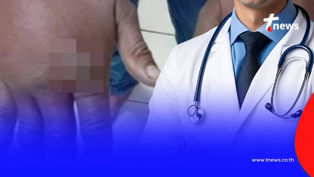 เปิดอาการ "โรคแอนแทรกซ์" หลังพบคนเสียชีวิต ใครมีดังนี้ หาหมอด่วน