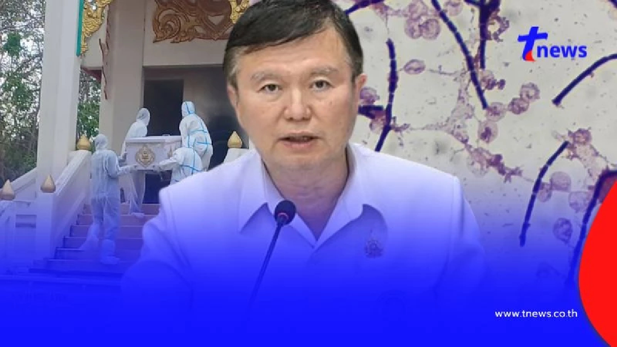 สธ.แจ้งพบผู้สัมผัสโรคแอนแทรกซ์ เสี่ยงสูง 247 คน ที่ต้องเฝ้าระวัง