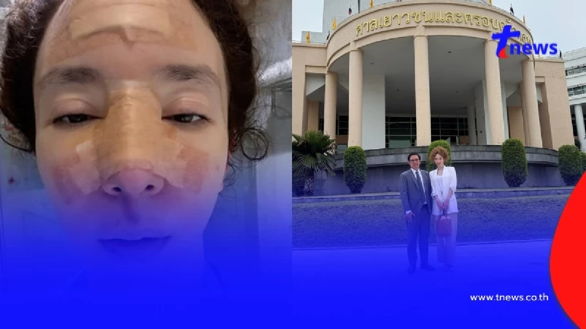 "คลาวเดีย" ยอมพูดแล้ว สาเหตุแท้จริง ล้มหัวฟาดพื้นเย็บกว่า 35 เข็ม