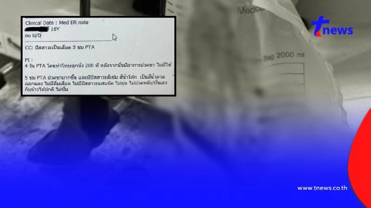 ครู สั่ง นร.ลุกนั่ง 200 ครั้ง จนกล้ามเนื้อสลาย เหตุผลทำโทษยิ่งตกใจ
