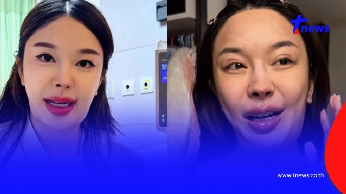 ยูทูบเบอร์ดัง ป่วยคอบวมโดนทักเป็น "มะเร็ง" ล่าสุดผลตรวจออกแล้ว