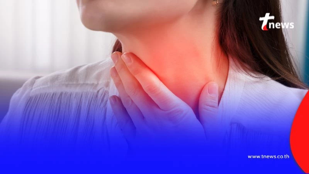โควิดหายแล้วแต่เจ็บคอไม่หาย ตรวจเจอ ไทรอยด์อักเสบ ตามหลังโควิด
