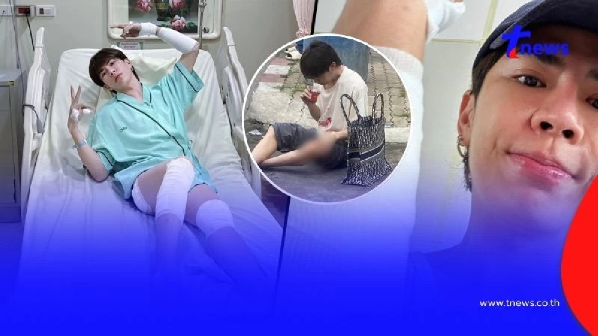 เอม ตามใจตุ๊ด เปิดภาพบาดแผลวันเกิดอุบัติเหตุ หน้าปู่ย่าลอยมาเลย