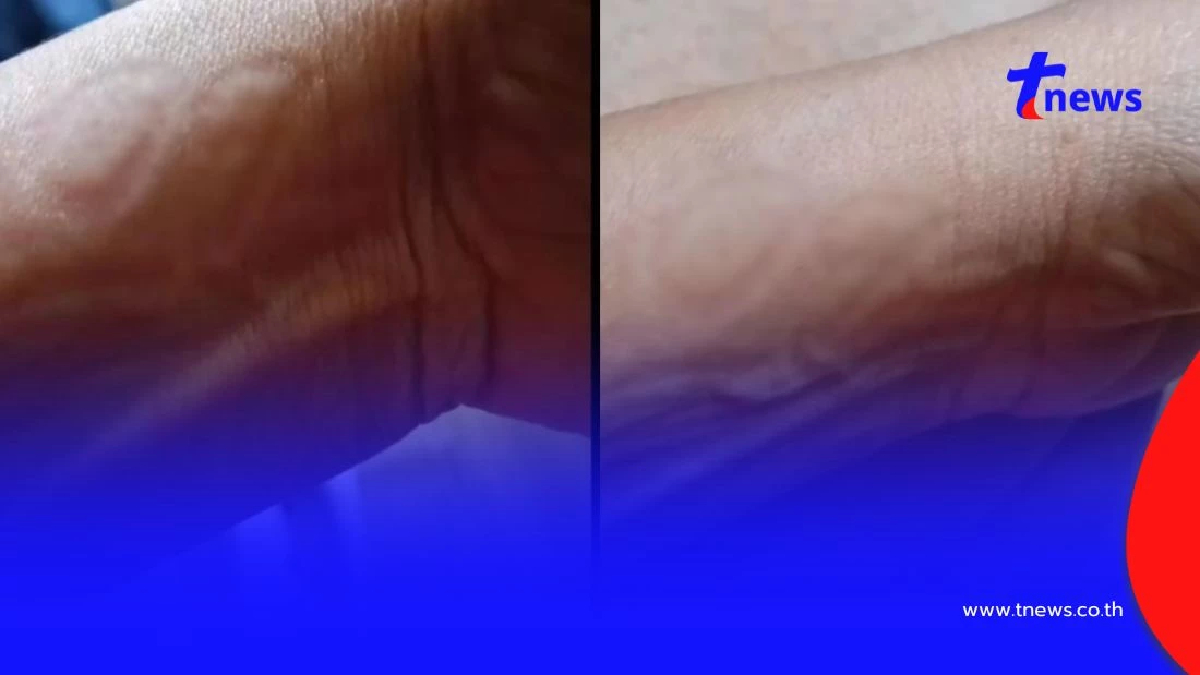 ฮือฮา เลขขึ้นบนแขน สาวฝันแปลกมีคนเอาแหวนทองมาสวมนิ้วให้