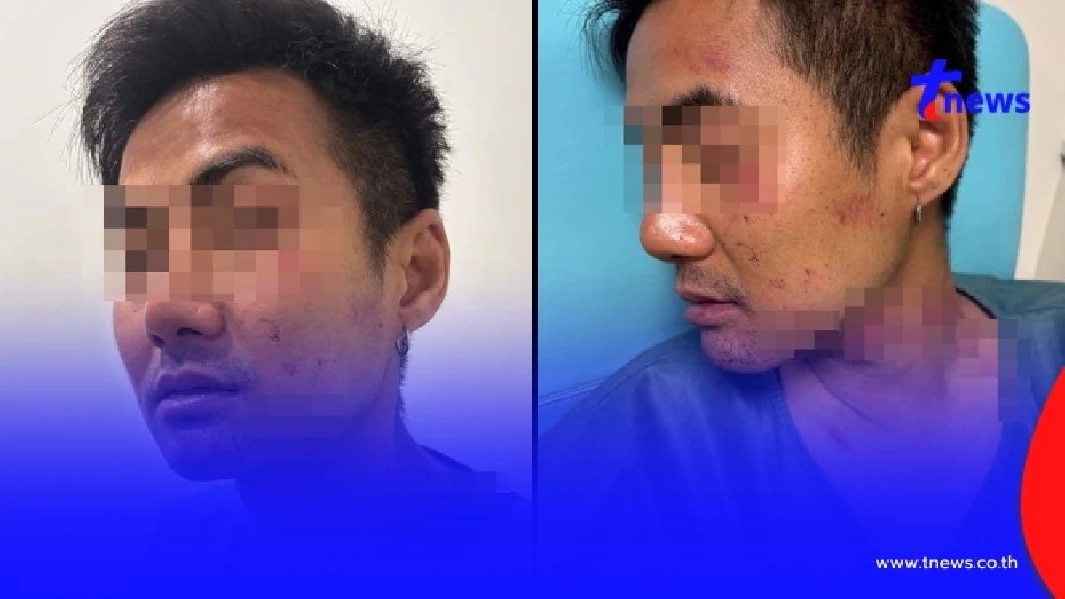 เกือบไม่รอด คนไทยในปารีส ถูกโจรปล้น ผลักล้ม-บีบคอจนหลอดลมอักเสบ