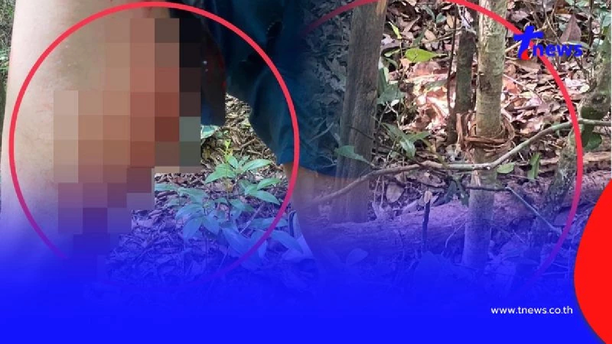 อันตรายมาก จนท.พิทักษ์ป่าภูเวียง ถูกจั่นห้าวยิงขา ขณะลาดตระเวน