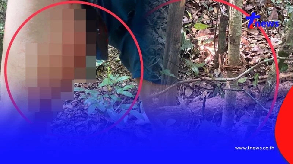 อันตรายมาก จนท.พิทักษ์ป่าภูเวียง ถูกจั่นห้าวยิงขา ขณะลาดตระเวน