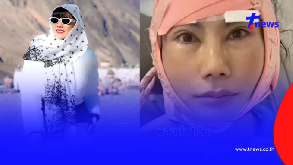 "แก้ว อภิรดี" เปิดหน้าใหม่หลังศัลฯ 2 เดือน ลืมไปเลยว่าใกล้แตะเลข 6