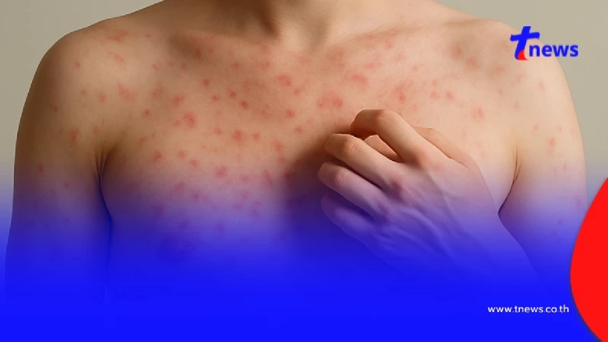 4 จังหวัด ติดเชื้อ HIV เพิ่มมากขึ้น - กลุ่มที่ติดเชื้อเพิ่มมากสุด