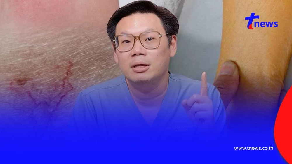 "หมอเจด" เตือนรีบเช็กด่วน 5 สัญญาณผิวแบบนี้ ระวัง "มะเร็งตับ"