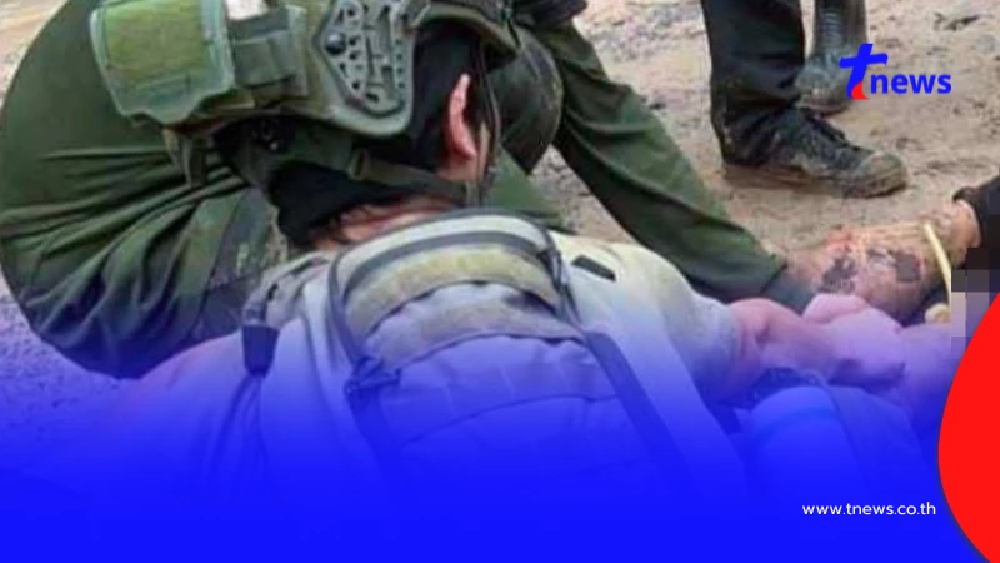 เปิดชื่อทหารกล้า สูญเสียขาหลังเหยียบกับระเบิดใกล้ปราสาทตาควาย