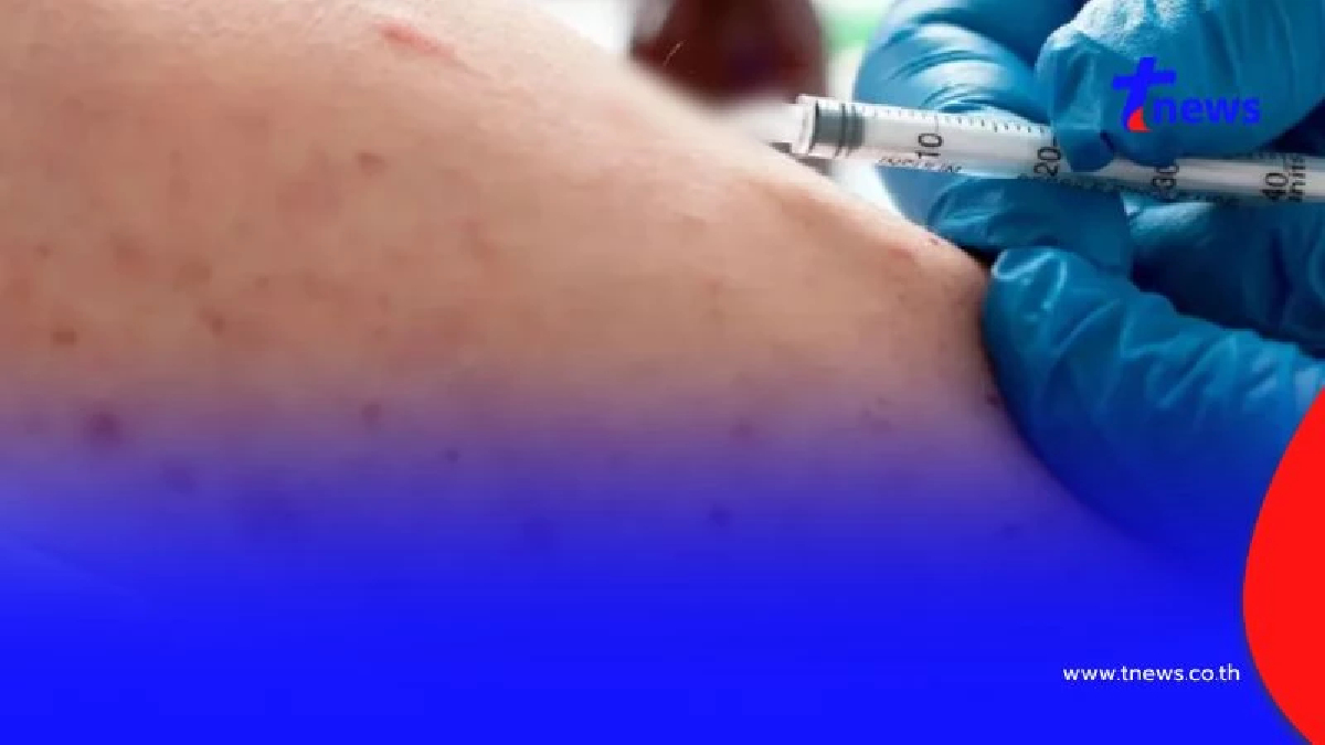 เตือนระวังโรคไข้ดิน ดับแล้ว 92 ราย เผยกลุ่มไหนเสี่ยงมากสุด