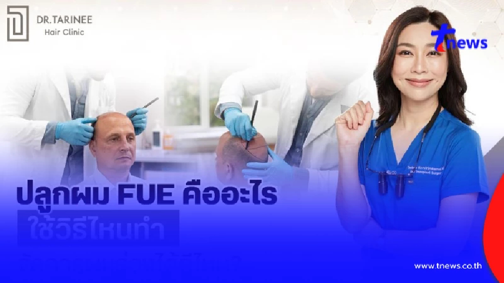 ปลูกผม FUE คืออะไร ทำด้วยวิธีไหน แก้ปัญหาผมร่วงได้ดีไหม?
