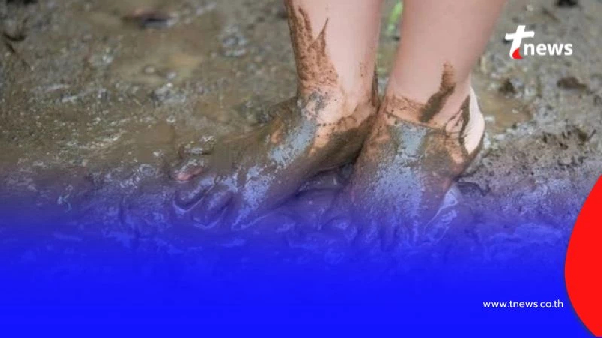 อย่ามองข้าม “โรคไข้ดิน” คร่าชีวิตไปแล้ว 92 ราย เสี่ยงสูงในภาคอีสาน