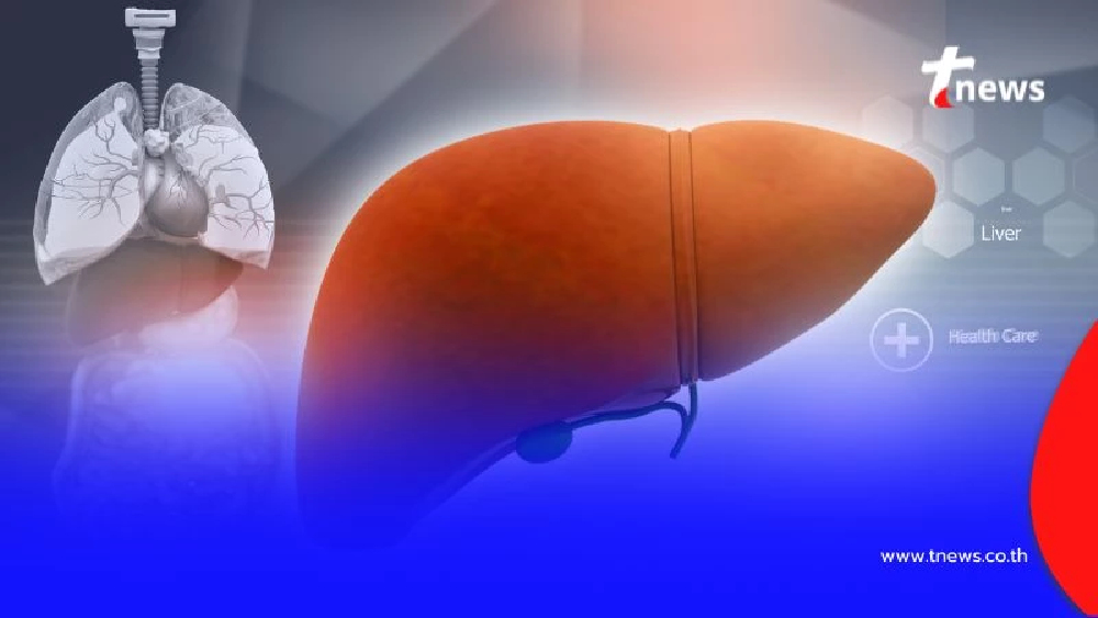 ชายวัย 54 ดื่มสิ่งนี้ แค่สัปดาห์เดียว ตับวายเฉียบพลัน ทั้งที่ไม่แตะแอลกอฮอล์