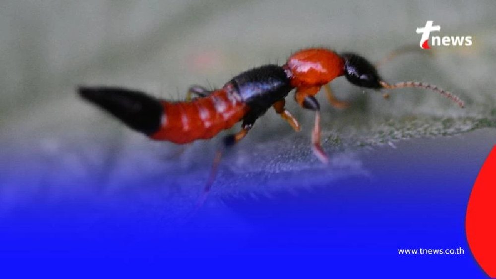 แมลงก้นกระดก อันตรายกว่าที่คิด โดยเฉพาะกับผู้ป่วยโรคนี้