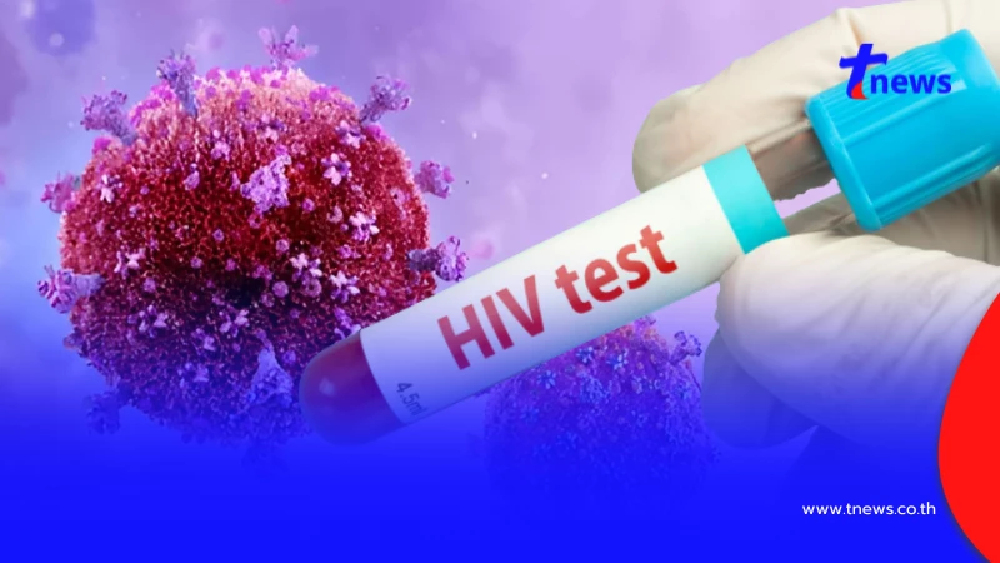 เปิด 10 จังหวัด เจอผู้ป่วย "เอชไอวี" พุ่งสูง อันดับ 1 รู้แล้วตกใจ