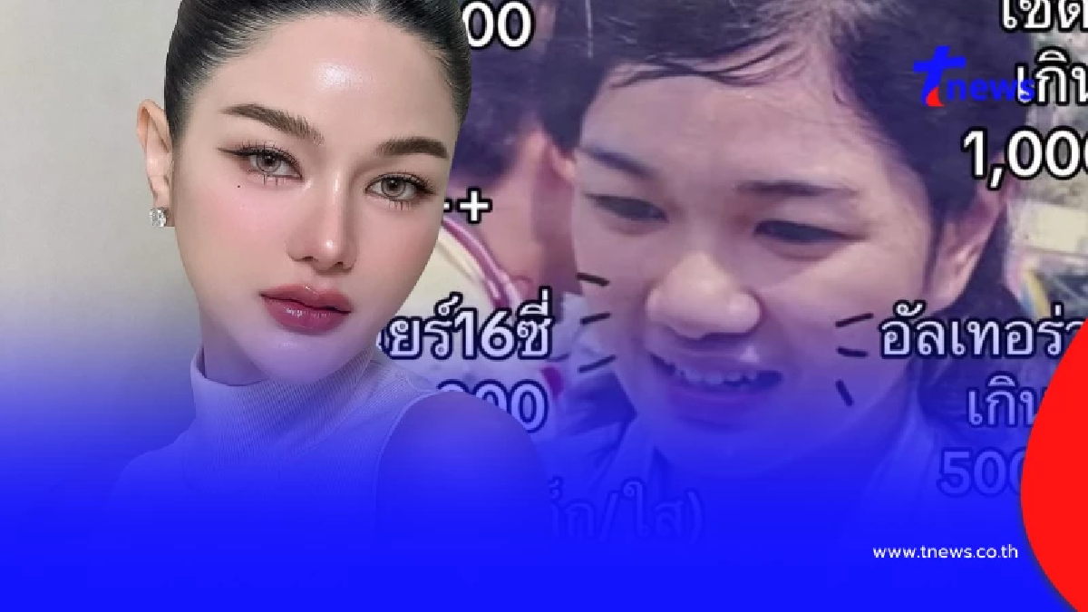 ดาราสาว เปิดภาพก่อนศัลยกรรม 16 ปี หมดไป 6 ล้าน คุ้มไหม ทำอะไรบ้าง